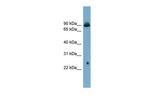 GlyT2 Antibody in Western Blot (WB)