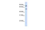 SLC27A4 Antibody in Western Blot (WB)