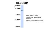 SLCO2B1 Antibody in Western Blot (WB)