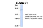 SLCO2B1 Antibody in Western Blot (WB)