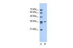 SLC35A3 Antibody in Western Blot (WB)