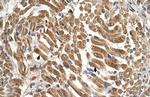 SLC17A5 Antibody in Immunohistochemistry (IHC)