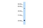 SLC17A5 Antibody in Western Blot (WB)