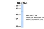 SLC2A8 Antibody in Western Blot (WB)