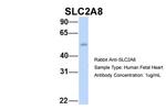 SLC2A8 Antibody in Western Blot (WB)