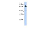 SLC9A8 Antibody in Western Blot (WB)