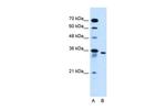 SLC25A32 Antibody in Western Blot (WB)