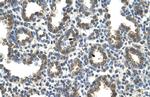 SLC37A3 Antibody in Immunohistochemistry (IHC)