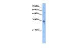 SLC25A16 Antibody in Western Blot (WB)