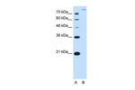 SLC26A5 Antibody in Western Blot (WB)