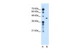 TGFBI Antibody in Western Blot (WB)