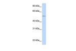 UGT1A1 Antibody in Western Blot (WB)