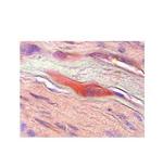 M-CSF Antibody in Immunohistochemistry (IHC)