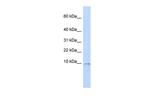 UCRC Antibody in Western Blot (WB)