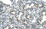 GPNMB Antibody in Immunohistochemistry (IHC)