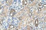 MGAT2 Antibody in Immunohistochemistry (IHC)