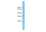 CCDC90A Antibody in Western Blot (WB)