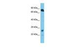 RHOT1 Antibody in Western Blot (WB)