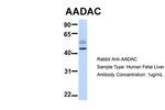 AADAC Antibody in Western Blot (WB)