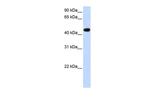 AADAC Antibody in Western Blot (WB)