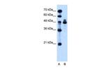 IHH Antibody in Western Blot (WB)