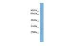 LTB Antibody in Western Blot (WB)