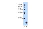 PLP2 Antibody in Western Blot (WB)