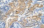 PTPN2 Antibody in Immunohistochemistry (IHC)