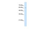 ZP2 Antibody in Western Blot (WB)