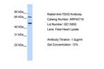 TDO2 Antibody in Western Blot (WB)