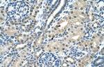 SBDS Antibody in Immunohistochemistry (IHC)