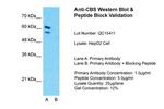 CBS Antibody in Western Blot (WB)