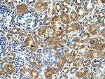 Cystatin B Antibody in Immunocytochemistry (ICC/IF)