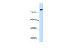 SIK1 Antibody in Western Blot (WB)