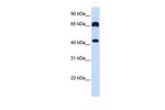 GUCY1B3 Antibody in Western Blot (WB)