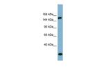 EPRS Antibody in Western Blot (WB)