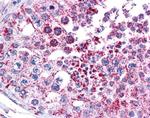 MAGEA3 Antibody in Immunohistochemistry (IHC)