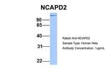 NCAPD2 Antibody in Western Blot (WB)