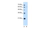 CDT1 Antibody in Western Blot (WB)