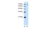 TARS Antibody in Western Blot (WB)