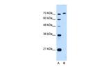 GPAA1 Antibody in Western Blot (WB)