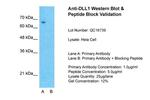 DLL1 Antibody in Western Blot (WB)