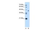 ST3GAL4 Antibody in Western Blot (WB)