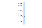 ST3GAL3 Antibody in Western Blot (WB)