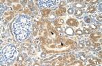 SPTLC1 Antibody in Immunohistochemistry (IHC)