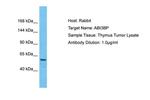 ABI3BP Antibody in Western Blot (WB)