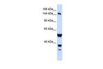 ABI3BP Antibody in Western Blot (WB)