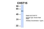 CHST15 Antibody in Western Blot (WB)