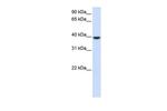 AGPAT5 Antibody in Western Blot (WB)