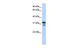 LAPTM4B Antibody in Western Blot (WB)